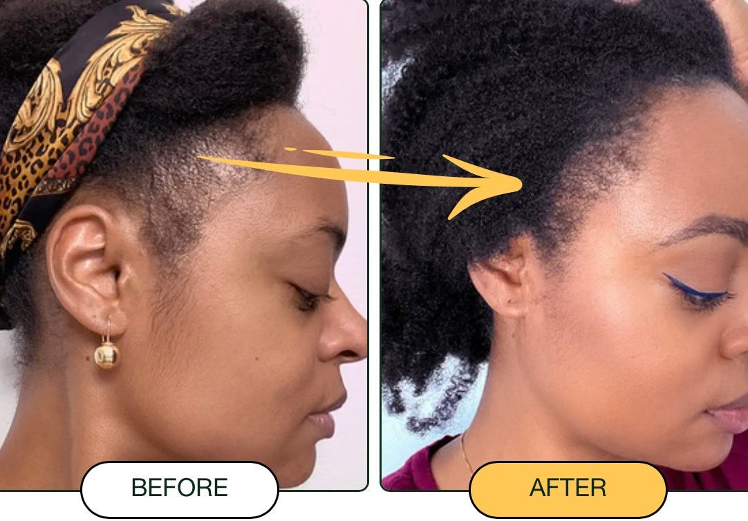 Batana Fortifying Oil Intense Hair Care